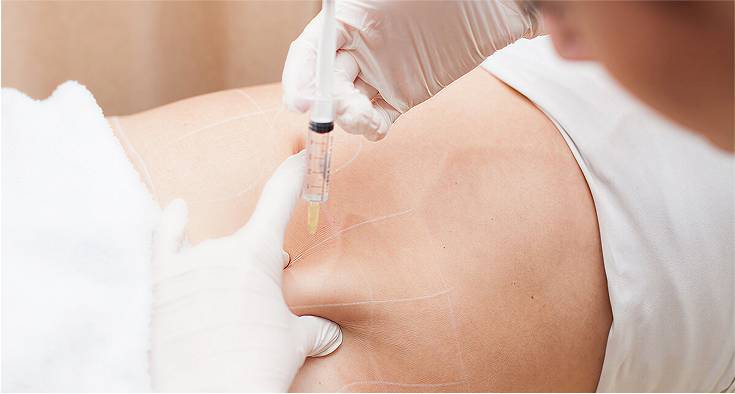 Lemon bottle injection