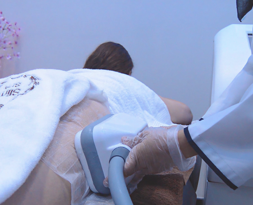 Cooltech Treatment